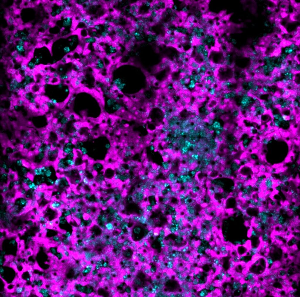 organoid assays acetaminophen