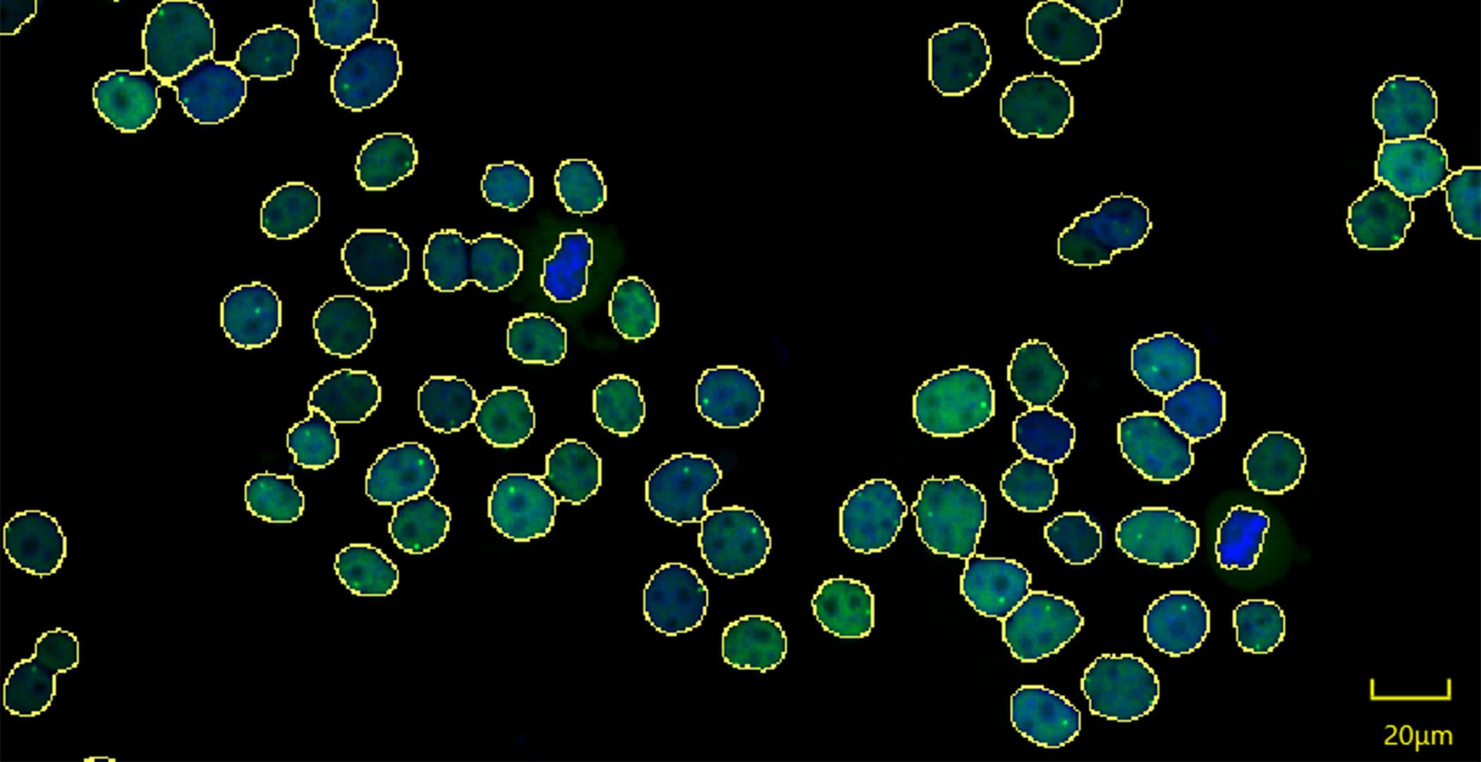 Imaging Single-Cell Gene Transcription - Life Innovation Blog