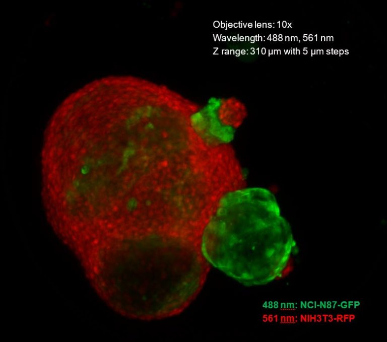 high content imaging tumor image