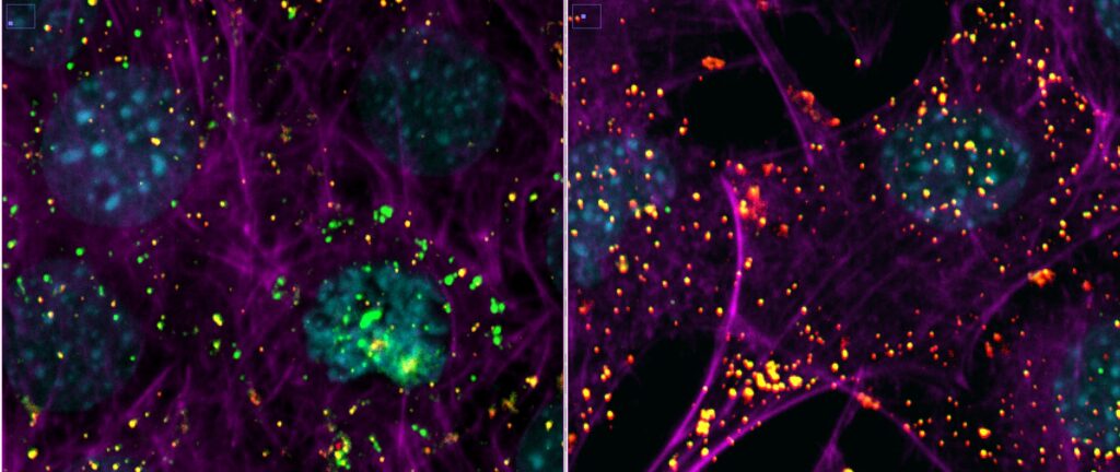 SARS-CoV-2 cell entry 