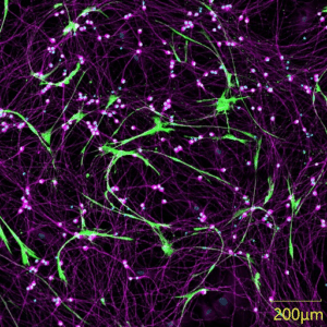 High-Content neurotoxicity Drug Screening in ...